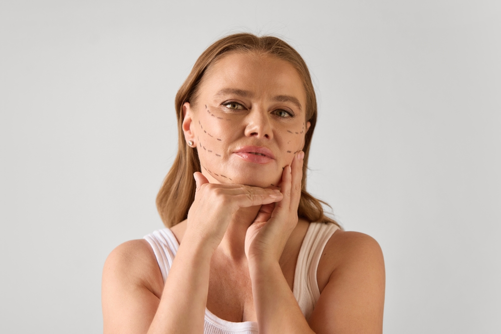 Facial Lines