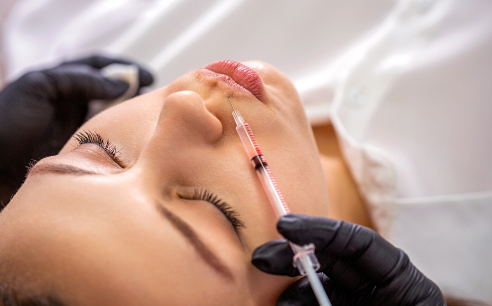 Fillers Around Lips